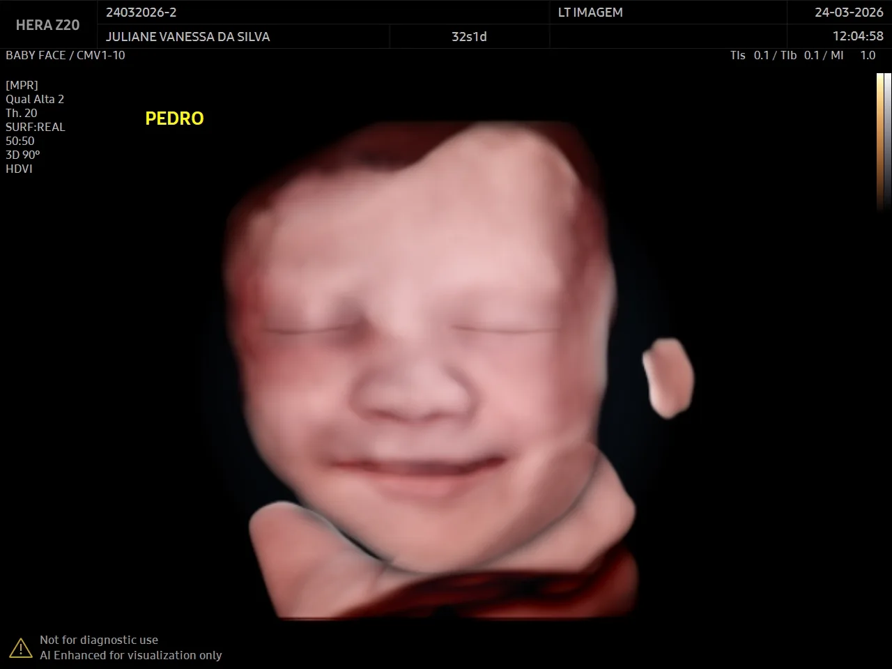 Lembrança Baby Click — bebê Pedro